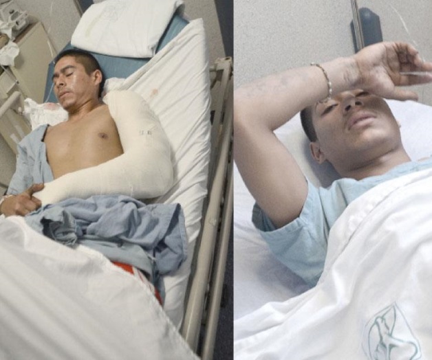 Los balea asaltante Los balea asaltante