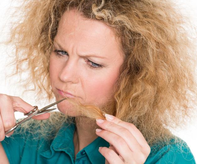 ¿Cabello rebelde? Quizá sufra un raro síndrome