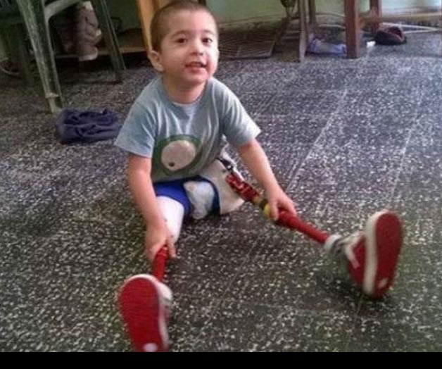 Asaltantes roban prótesis de niño sin piernas que aprendía a caminar Asaltantes roban prótesis de niño sin piernas que aprendía a caminar