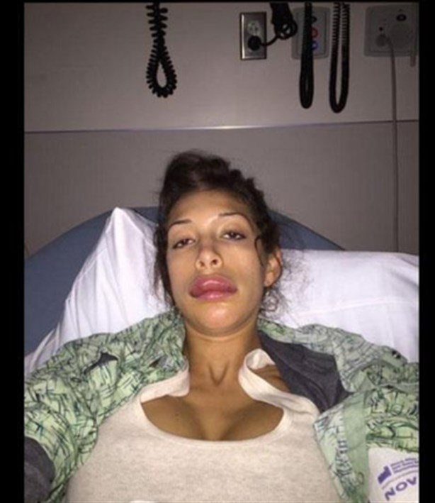 Estrella porno impacta en redes sociales tras inyectarse los labios Estrella porno impacta en redes sociales tras inyectarse los labios