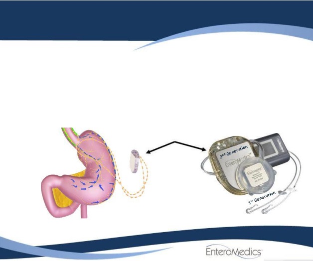 EU aprobó un dispositivo electrónico contra la obesidad