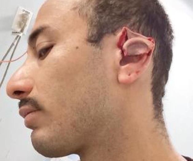 Policía mutila oreja a ciudadano; autoridad no repara daño Policía mutila oreja a ciudadano; autoridad no repara daño