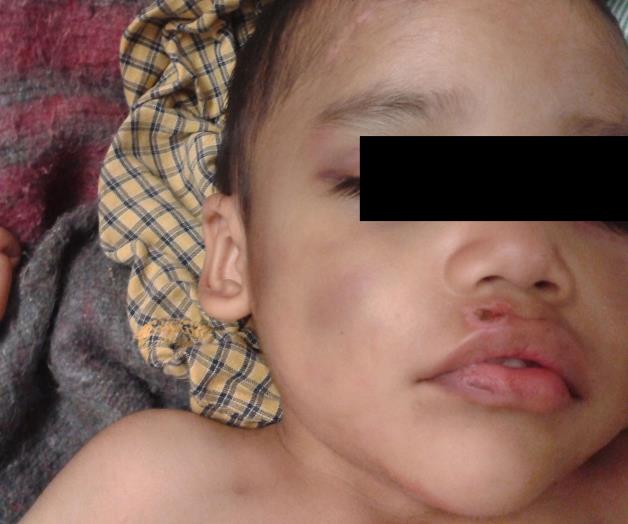 Arrestan a padrastro por lesionar a niño