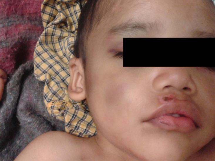 Arrestan a padrastro por lesionar a niño Arrestan a padrastro por lesionar a niño