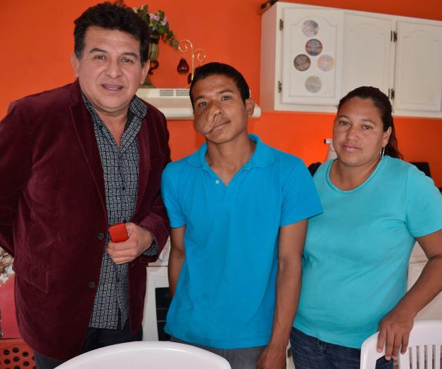 Operarán el 9 de febreroal niño con tumor facial