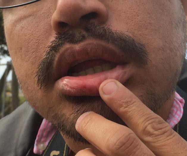 Ataca a reportero funcionaria local