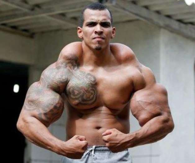 Este joven brasileño quería lucir como Hulk y casi pierde los brazos