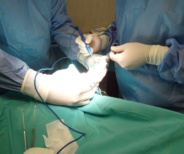 Aprenden sobre usodel ‘bisturí armónico’