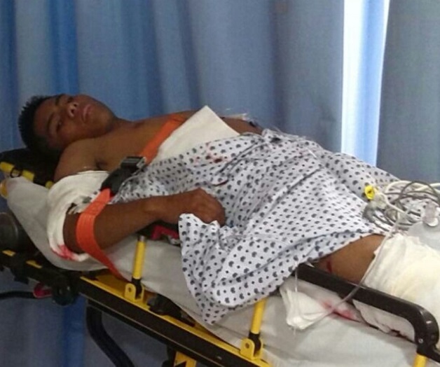 Podría perder una pierna por heridas de bala