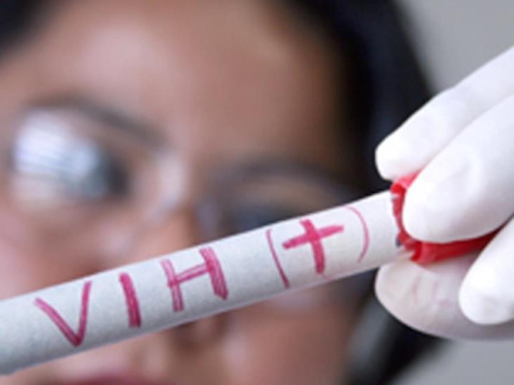Estiman 180 mil infectados con VIH en México Estiman 180 mil infectados con VIH en México