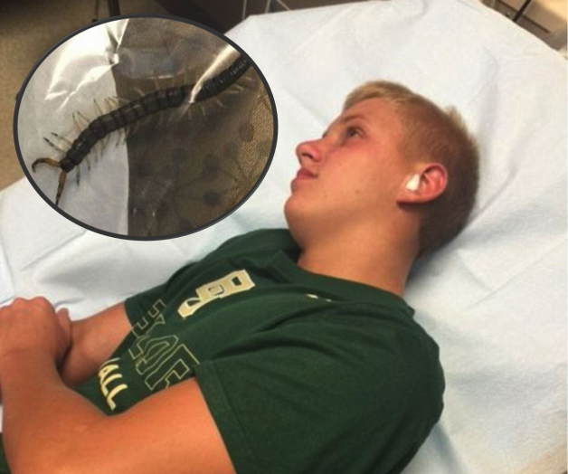 Extraen cienpiés de oreja de un joven