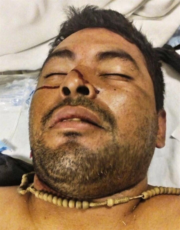 Cae secuestrador; matrimonio lo arrolla para evitar ultraje