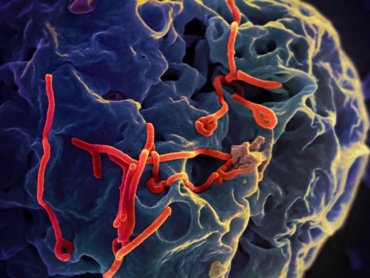 Nuevo caso sospechoso de ébola en Italia Nuevo caso sospechoso de ébola en Italia