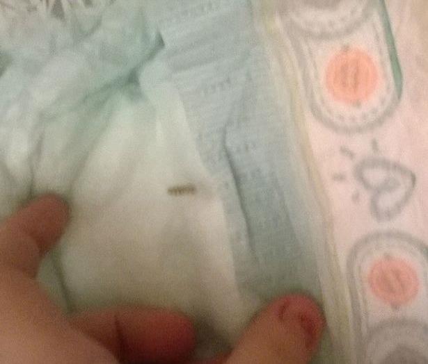 Mamá horrorizada encuentra tornillo de 2 pulgadas en pañal de su bebé Mamá horrorizada encuentra tornillo de 2 pulgadas en pañal de su bebé