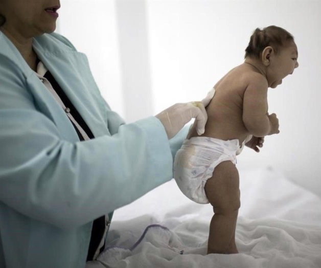 Aumenta evidencia de zika-microcefalia