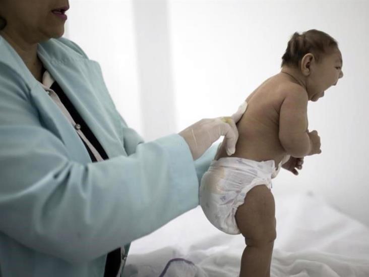 Aumenta evidencia de zika-microcefalia Aumenta evidencia de zika-microcefalia