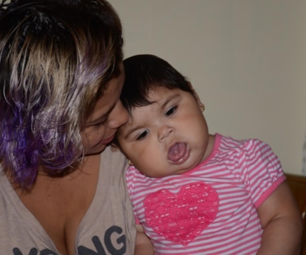 Tiene bebé una rara enfermedad en lengua