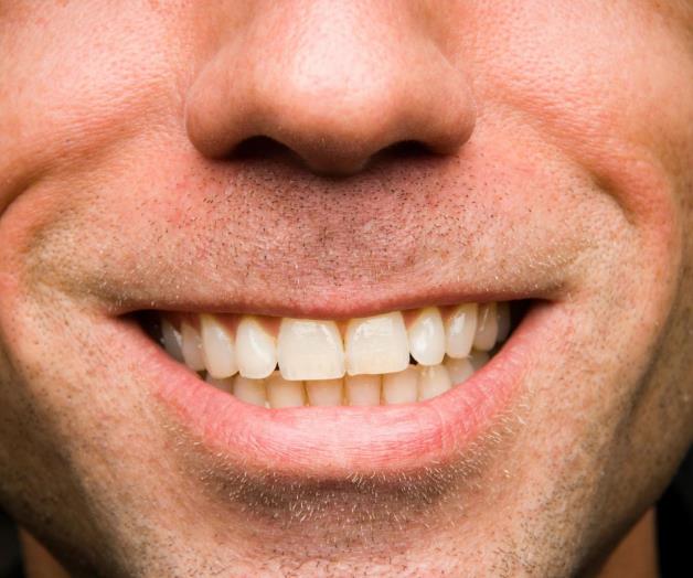 Expertos afirman que infecciones por hacer sexo oral van en aumento