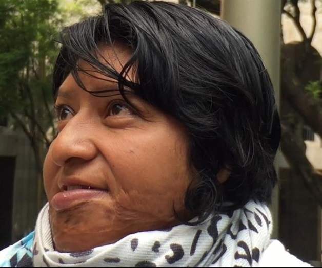 Reconstruyen su rostro 36 años después