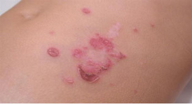 Desarrolla fármacos IPN