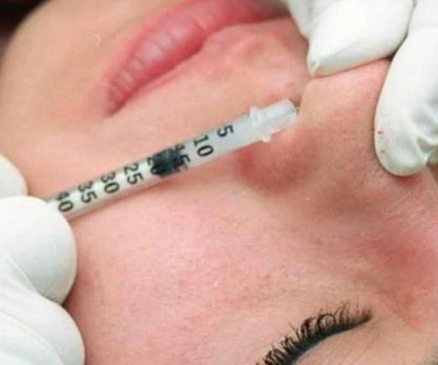 Hallan en nariz humana antídoto contra bacteria asesina Hallan en nariz humana antídoto contra bacteria asesina
