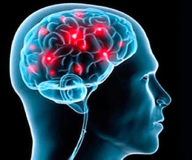 Necesario educar para prevenir un infarto cerebral: neurólogos