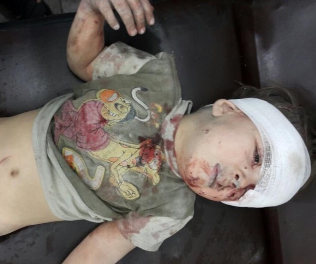 Niño sobreviviente estremece al mundo; Fue rescatado de entre los escombros en Siria