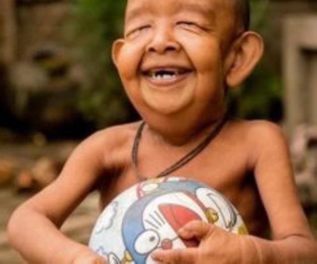 Benjamin Button sí existe Benjamin Button sí existe