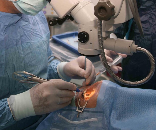 Superan cataratas 287 pacientes del IMSS