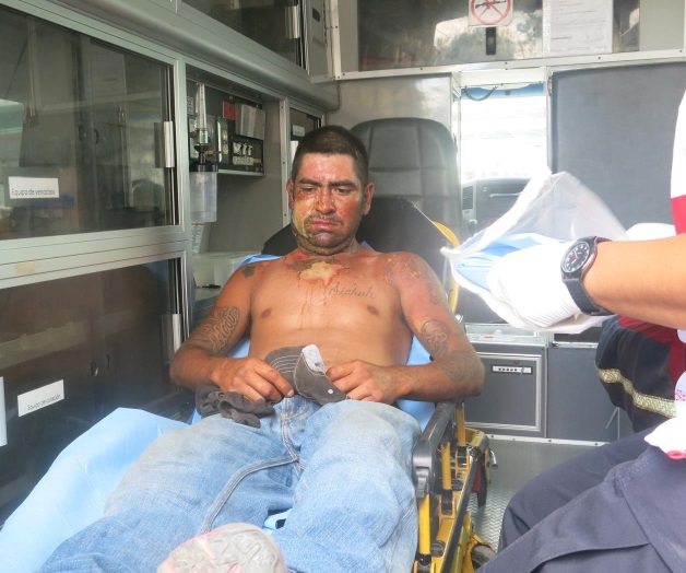 Sufre quemaduras un aprendiz de ‘dragón’