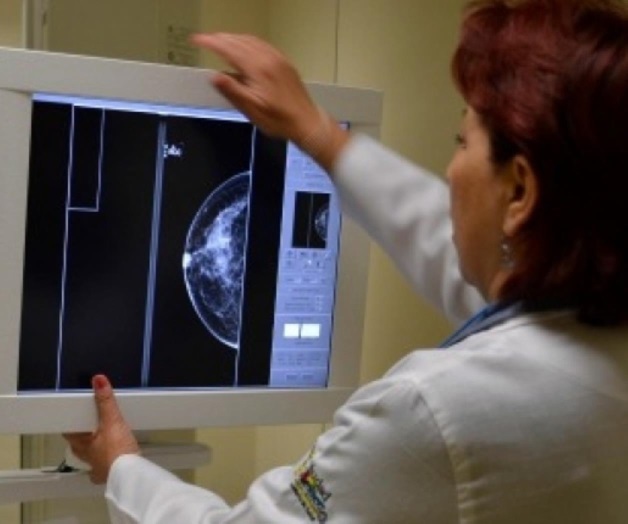 Nueva terapia hormonal alarga sobrevida a pacientes con cáncer de mama