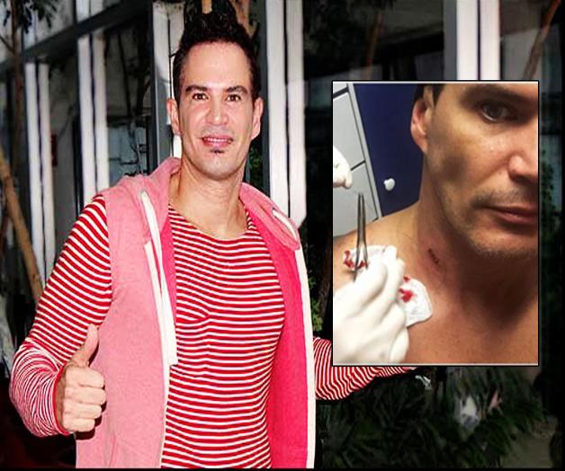 Julio Camejo recibe cuatro puñaladas durante asalto