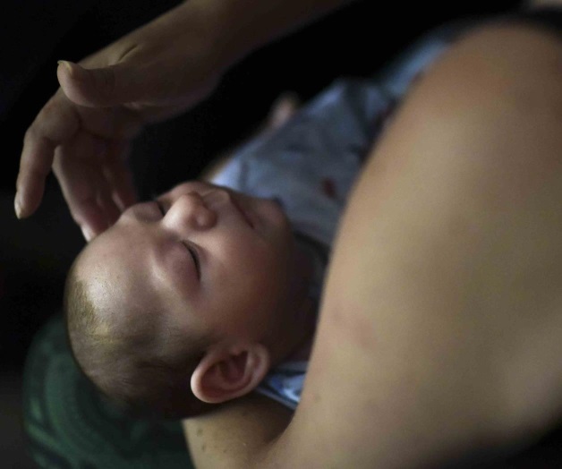 Un bebé nacido con microcefalia tiene zika Un bebé nacido con microcefalia tiene zika