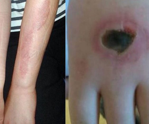 Hacen nuevo reto viral con la sal y el hielo, desafío que manda al hospital Hacen nuevo reto viral con la sal y el hielo, desafío que manda al hospital