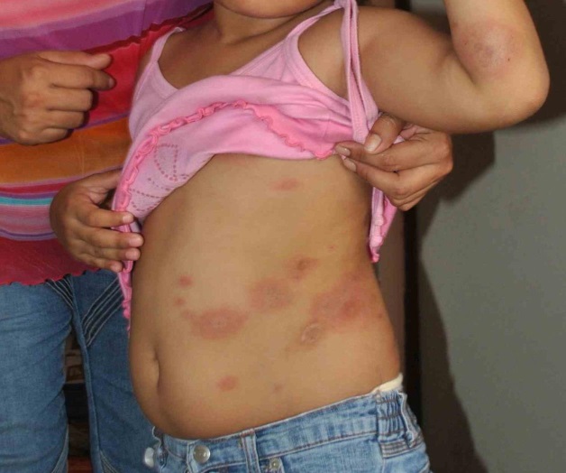 Sin casos en el ISSSTE