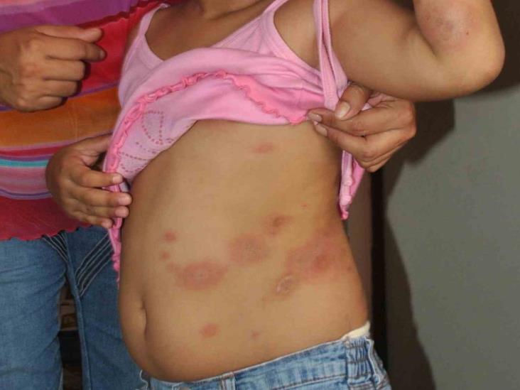 Sin casos en el ISSSTE Sin casos en el ISSSTE