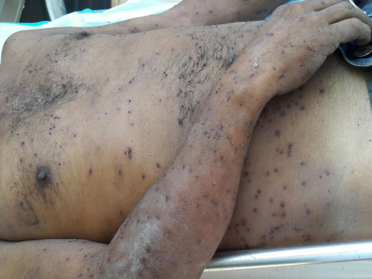 ¡Abejas asesinas! en Díaz Ordaz ¡Abejas asesinas! en Díaz Ordaz
