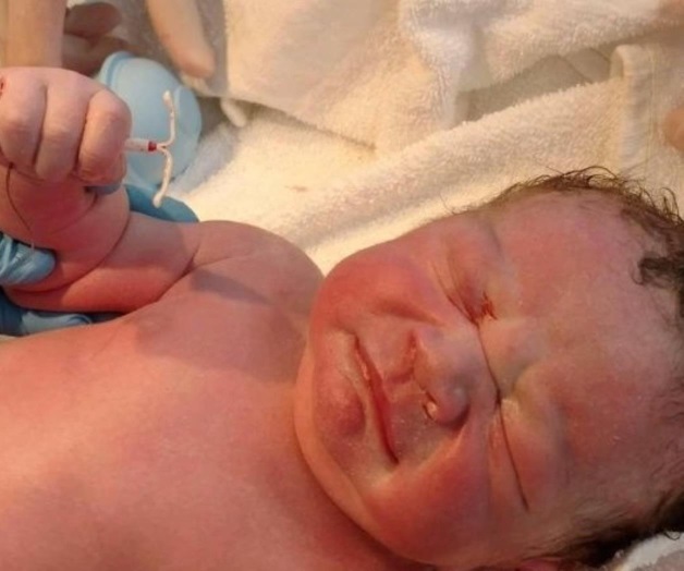 Nace bebé con el dispositivo DIU de su mamá en la mano Nace bebé con el dispositivo DIU de su mamá en la mano