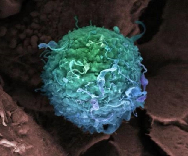 Descubren nueva clave para frenar metástasis del cáncer de mama