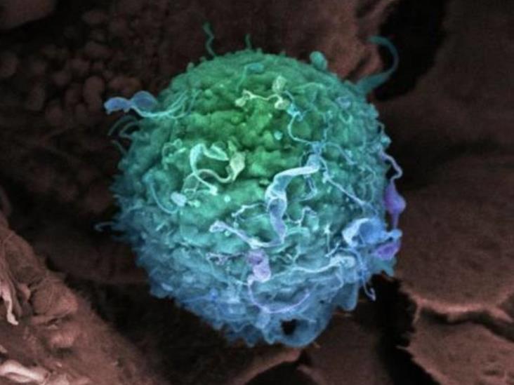 Descubren nueva clave para frenar metástasis del cáncer de mama Descubren nueva clave para frenar metástasis del cáncer de mama