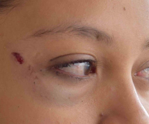 Denuncia ama de casa brutal ataque de esposo Denuncia ama de casa brutal ataque de esposo