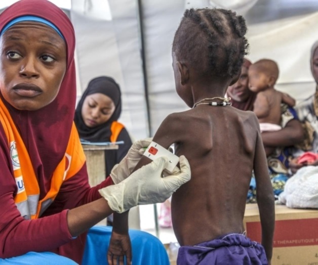 Cólera cobra la vida de 471 personas y deja más de 51 mil infectados en Yemen