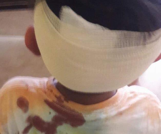 Descalabran a niño especial en un CAM de Madero Descalabran a niño especial en un CAM de Madero