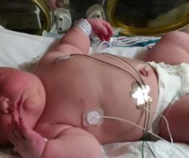 Mujer da a luz a una bebé muy grande Mujer da a luz a una bebé muy grande