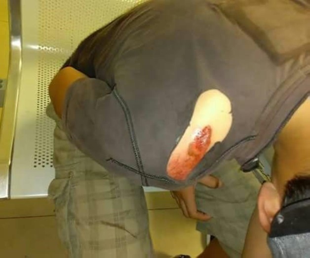 Ataca Pitbull a niño y casi lo mata Ataca Pitbull a niño y casi lo mata