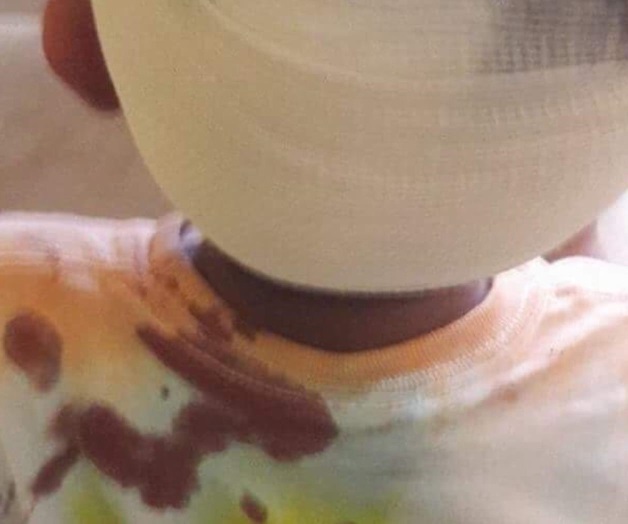 Descalabran a un niño discapacitado Descalabran a un niño discapacitado