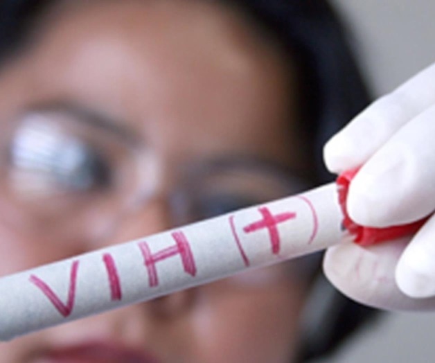 Suben casos de SIDA en Tamaulipas. Encienden focos rojos Suben casos de SIDA en Tamaulipas. Encienden focos rojos