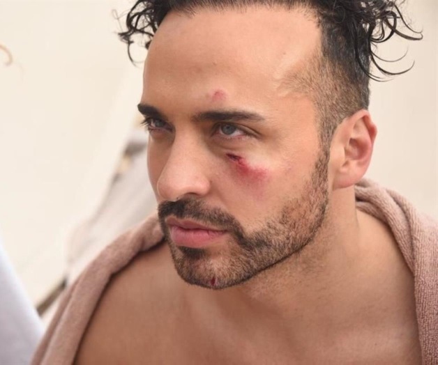 Sufren accidente grabando clip Sufren accidente grabando clip