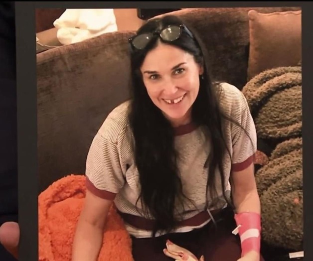 Pierde dos dientes por estrés Pierde dos dientes por estrés