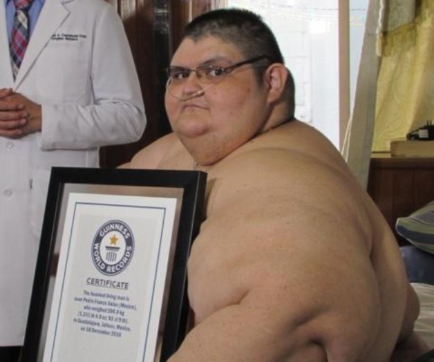 El hombre más obeso del mundo se levanta de la cama por primera vez